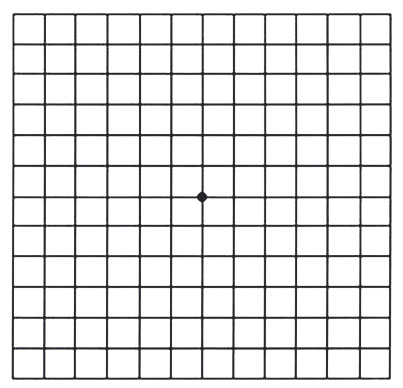 amsler-grid2.jpg